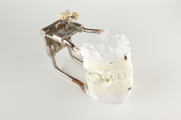 What You Need To Know About Bone Graft Procedures