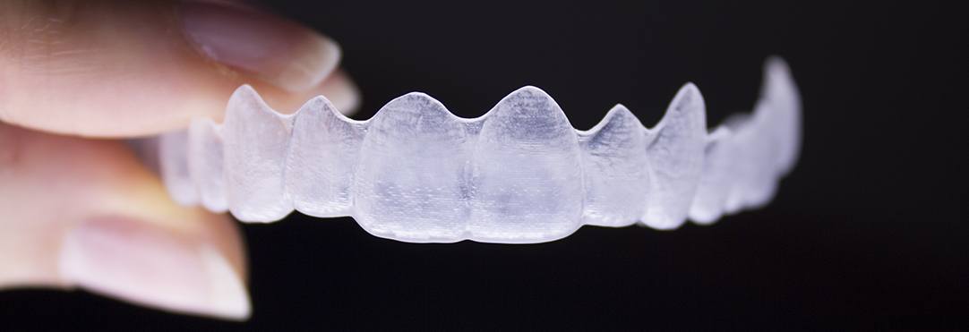 Chicago Clear Aligners