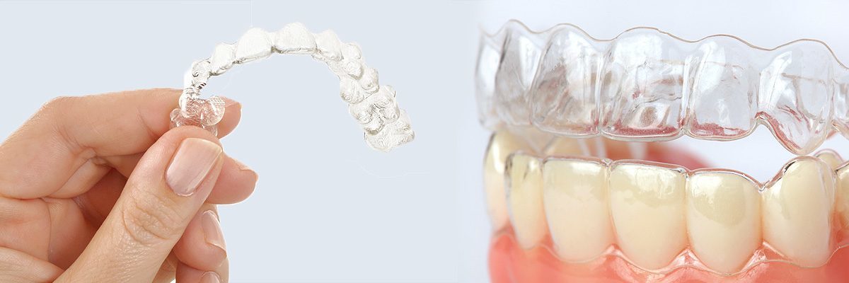 Chicago Clear Aligners