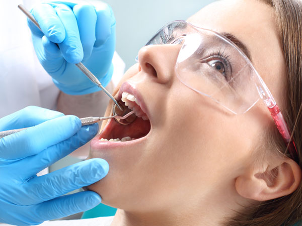 Chicago Composite Fillings