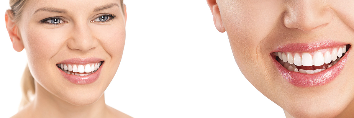 Chicago Cosmetic Dental Services