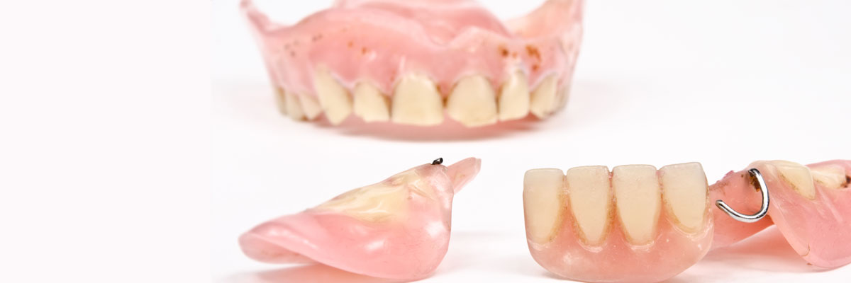 Chicago What Do I Do If I Damage My Dentures?
