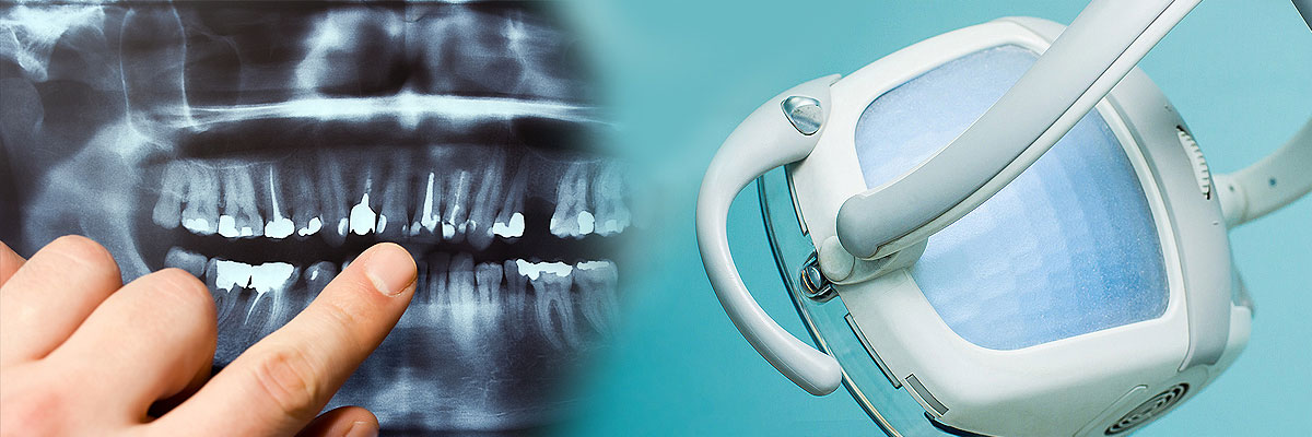 Chicago Dental Cleaning