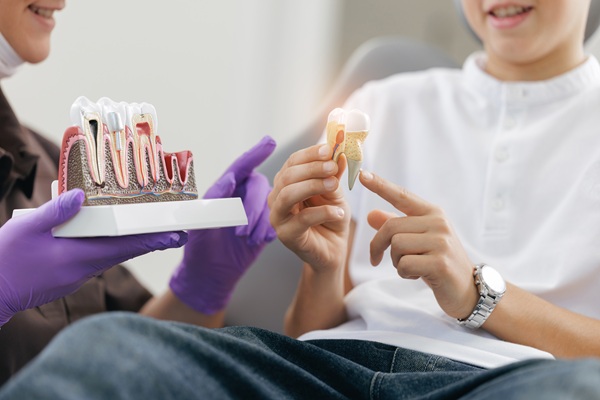 Dental Restoration    : Should I Get A Dental Crown Or Filling?
