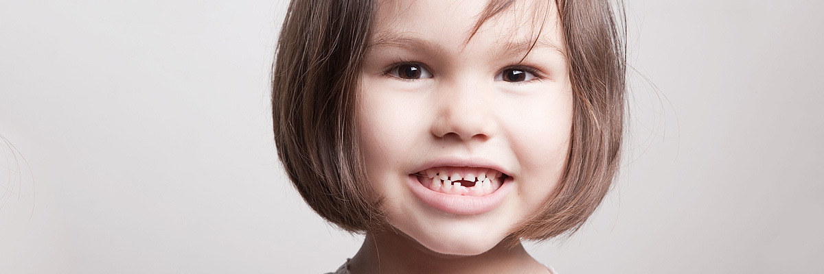 Chicago Dental Restoration