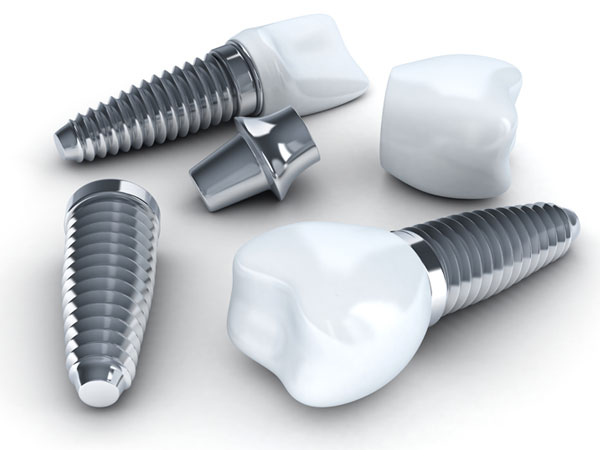 Chicago The Difference Between Dental Implants and Mini Dental Implants
