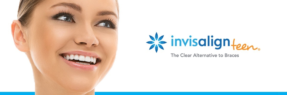 Chicago Invisalign vs Traditional Braces