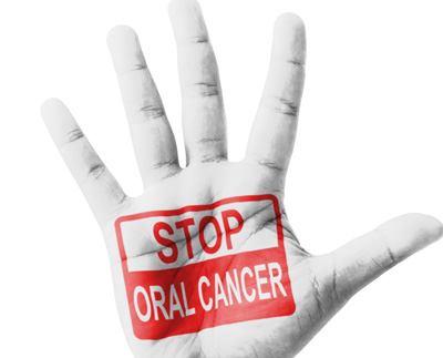 Chicago Oral Cancer Screening