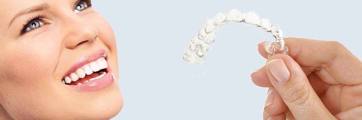 Chicago 7 Things Parents Need to Know About Invisalign Teen