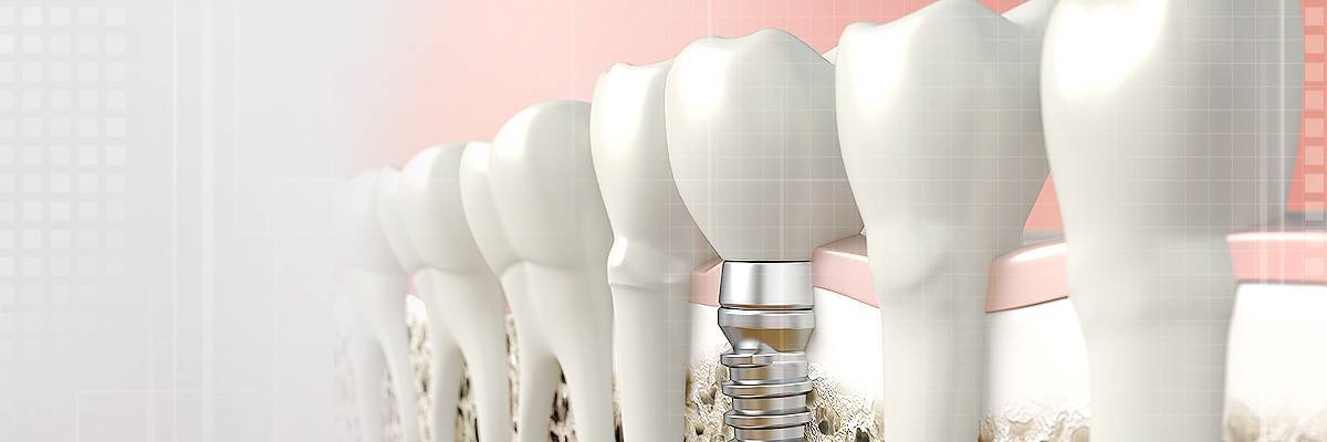 Chicago Periodontics