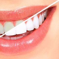 Chicago Professional Teeth Whitening