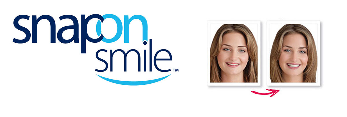 Chicago Snap-On Smile