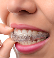 Clear Aligners - Almost Invisible Braces Chicago, IL