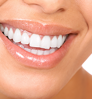 Teeth Whitening Services Chicago, IL