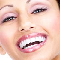 Chicago Teeth Whitening at Dentist