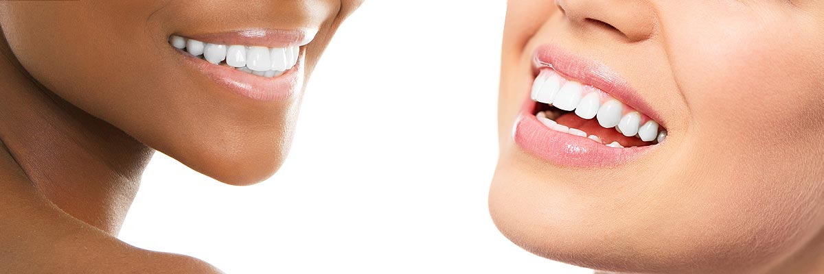 Teeth Whitening Chicago Il Tooth Bleaching Dentist Teeth Whitening Chicago Il Tooth Bleaching Dentist