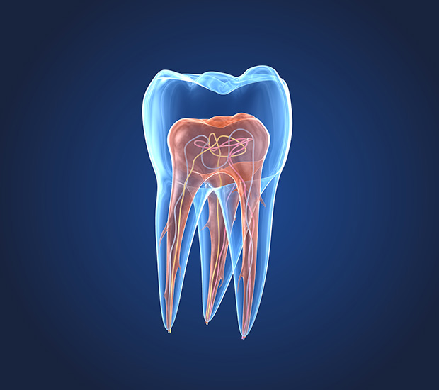 Chicago What is an Endodontist