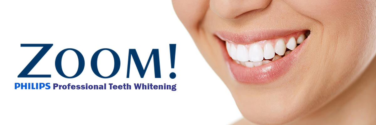Chicago Zoom Teeth Whitening